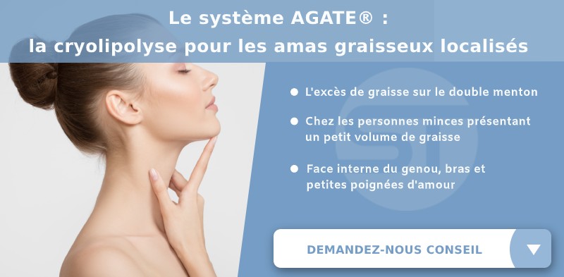 Excès de graisse du double menton éliminé grâce au système AGATE de la cryolipolyse